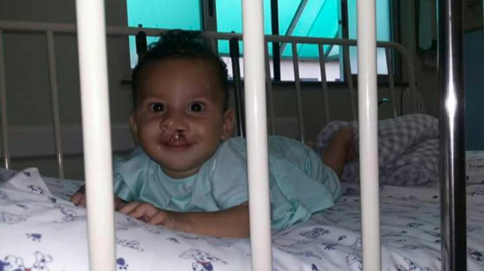 Sem explicação: bebê faz cirurgia no lábio e tem morte cerebral